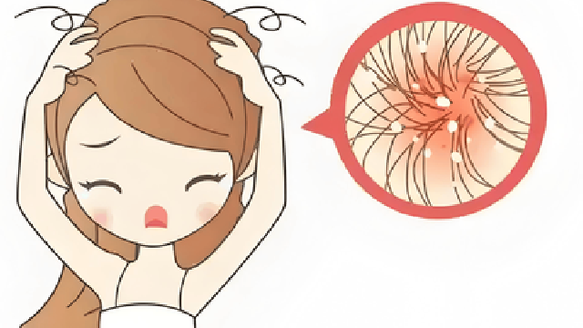 头皮抠出小米粒？4种情况速就医，严重可能是癌